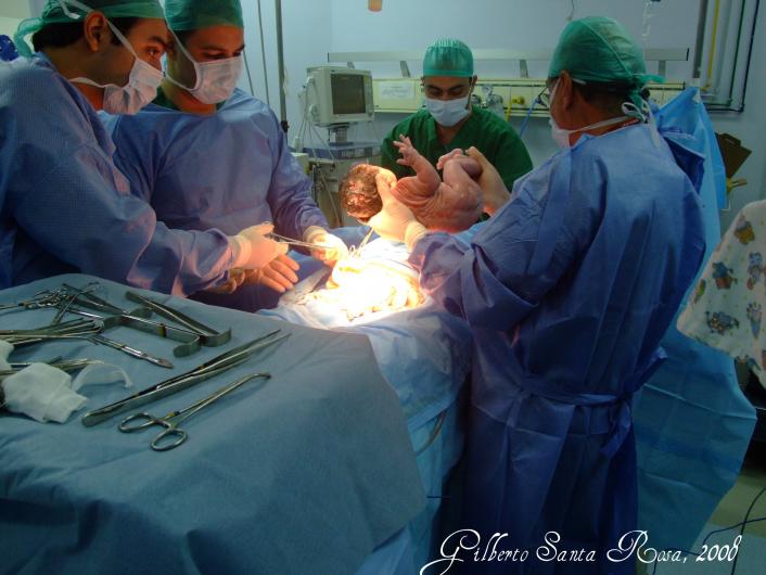 الولادة الطبيعة أم القيصرية.. أيهما أفضل وأكثر أمانا؟!