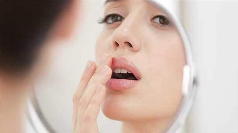 الفم الجاف.. أسباب خفية قد تكشف مشكلات صحية