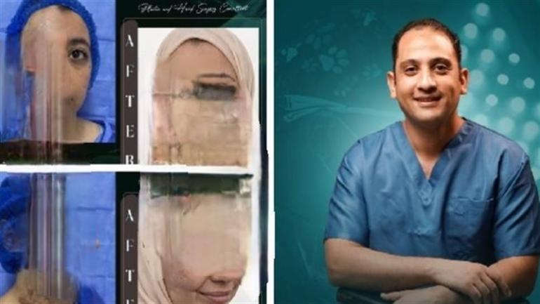 من تحت الركام إلى ملامح الحياة… فريق طبي مصري يعيد وجه الأمل لفتاة فلسطينية